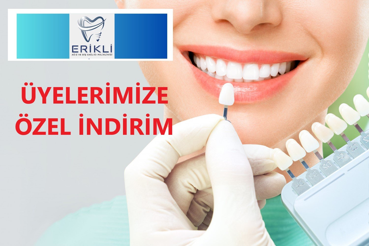 BURSA ERİKLİ AĞIZ VE DİŞ POLİKLİNİĞİNDEN ÜYELERİMİZE ÖZEL İNDİRİM